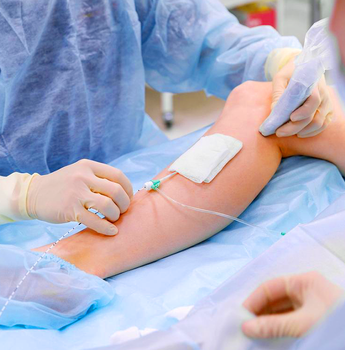 saúde vascular - Dr Felipe Barão