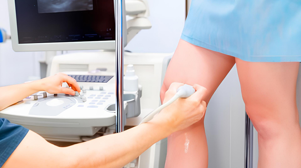Ultrassom Doppler