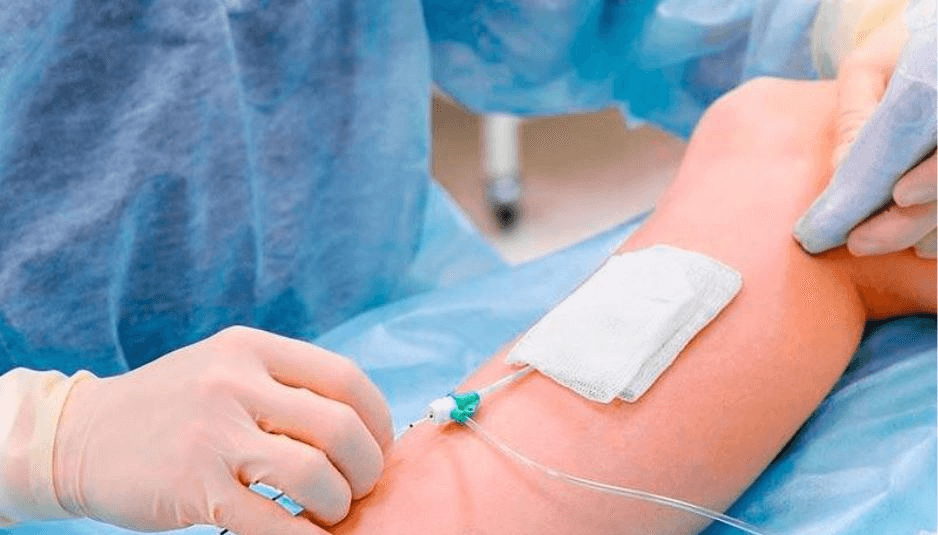 laser-endovenoso