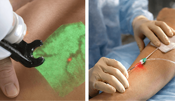 cirurgião vascular