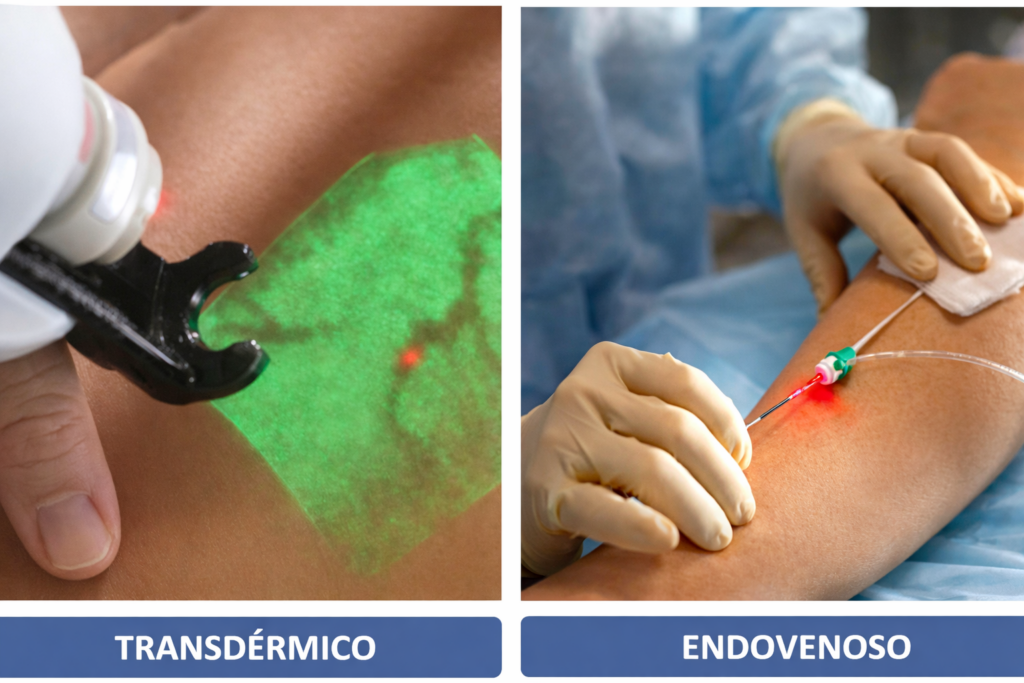 termico e endovenoso