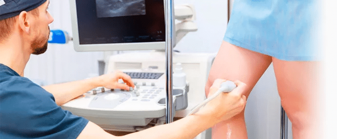 Ultrassom Doppler venoso