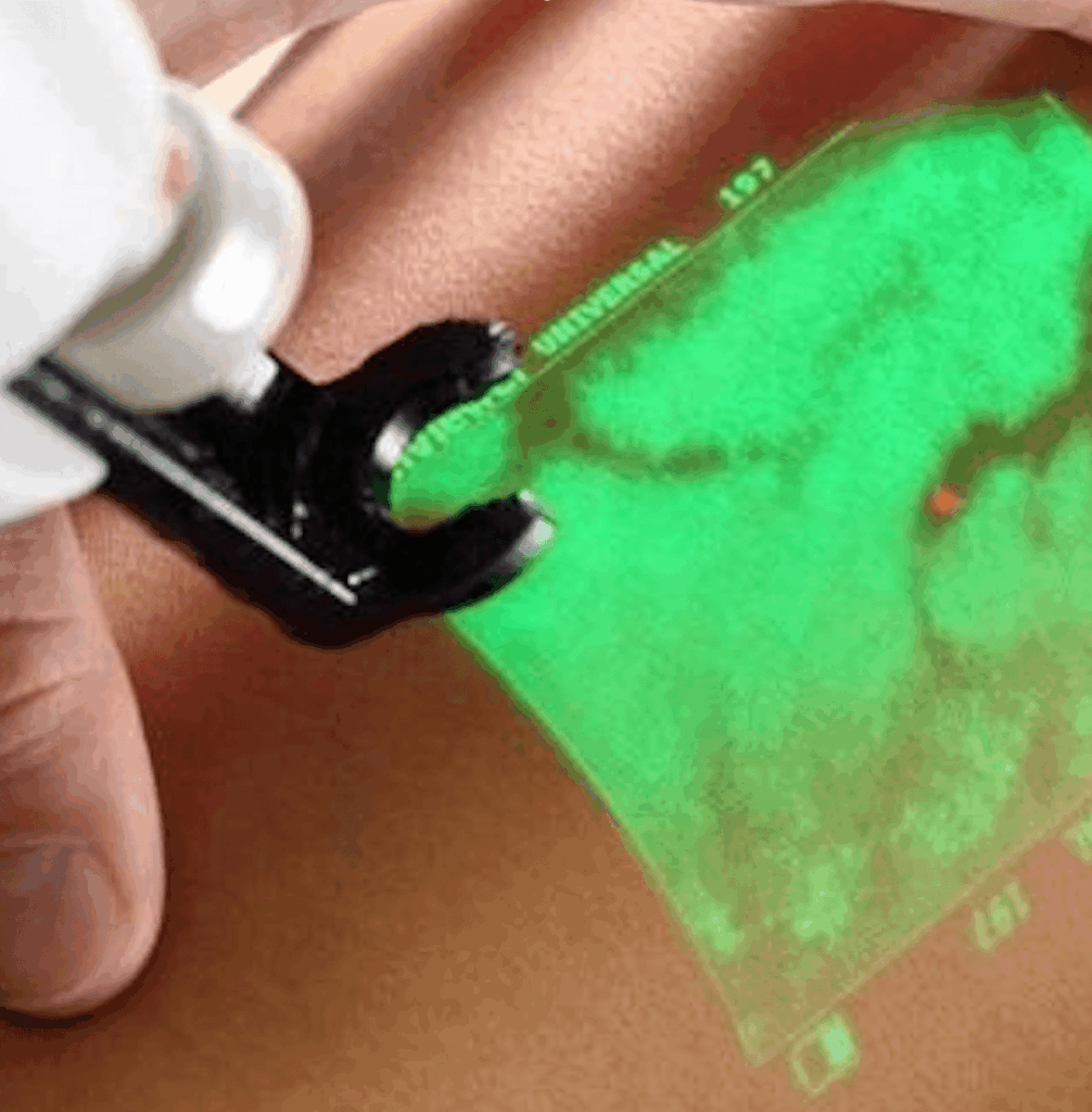 Cuidar da sua saúde vascular é mais do que tratar sintomas​